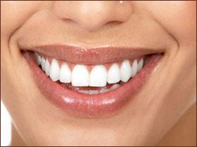 دندان سفید - سالم
