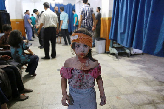 زخمی های سوری- داعش