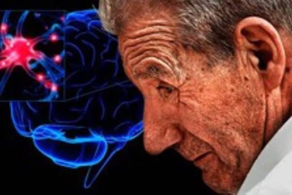 عوامل ابتلا به بیماری ALS/ تحلیل سلول های مغز و نخاع