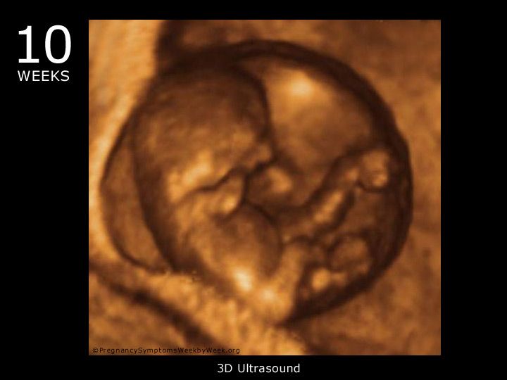 جنین در هفته دهم بارداری از خود صدا در می آورد+ تصاویر و علائم بارداری