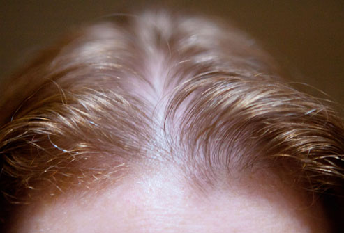 چند نکته برای داشتن مو‌های سالم/ هر روز به موهایتان شامپو نزنید