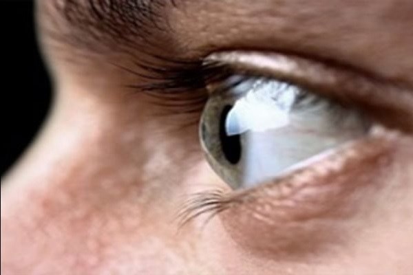 دلایل ایجاد و درمان خشکی چشم را بشناسید/ آیا مشکلات چشمی باعث ایجاد میگرن می‌شوند؟