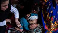 عوارض خطرناک بلع مواد سوزاننده توسط کودکان