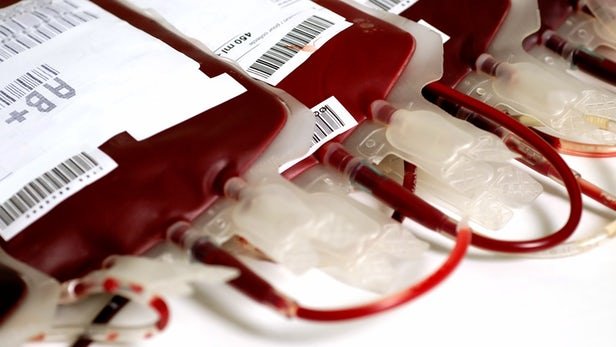 تفکیک پلاکت و پلاسما از خون/ پیشرفت ایران در توزیع و تامین فرآورده‌های خونی/ فراورده‌های خونی در همان مراحل اول از خون اهدا کننده جدا و در اختیار بیماران قرار می‌گیرد