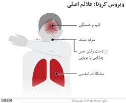 ببینید| چطور بیماری کرونا را تشخیص دهیم؟