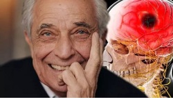 عجیب‌ترین علامت سکته مغزی در افراد