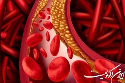 تأثیر رژیم غذایی و فعالیت بدنی بر غلظت چربی‌های خون