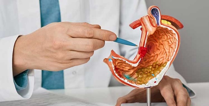 مهمترین نشانه «ورم معده»چیست؟