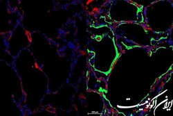 شناسایی پروتئینی در ریه که با کرونا مبارزه می‌کند