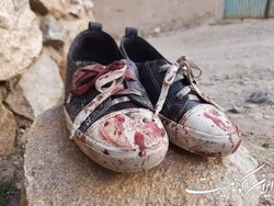سفارت کشورمان: جریان افراط در انجام جنایت به هیچ فرد مسلمانی اعم از شیعه و سنی رحم نمی‌کند
