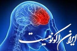 راهکاری برای کاهش خطر سکته مغزی