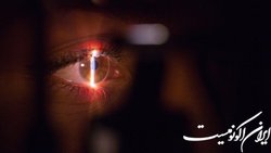 عرضه دستگاهی با قابلیت انجام ۲ عمل جراحی چشم در یک سیستم‌ واحد