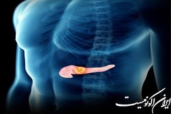 جلوگیری از گسترش سرطان پانکراس با یک پروتئین