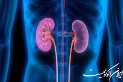 چند توصیه برای پیشگیری از سرطان کلیه