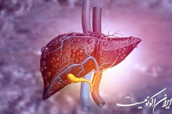 عوارض جانبی غیرمنتظره دم‌نوش  کاسنی  در مبتلایان به کبد چرب