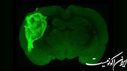 پرورش سلول‌های مغزی انسان در مغز موش