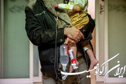 کاهش چشمگیر اعزام کودکان به خارج برای درمان