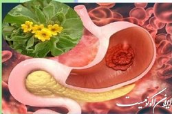 بررسی تأثیر عصاره گیاه شنگار بر تغییر بیان دو ژن در رده سلولی سرطان معده