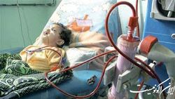 جان ۱۷۰ هزار بیمار یمنی در نتیجه تجاوز در خطر است