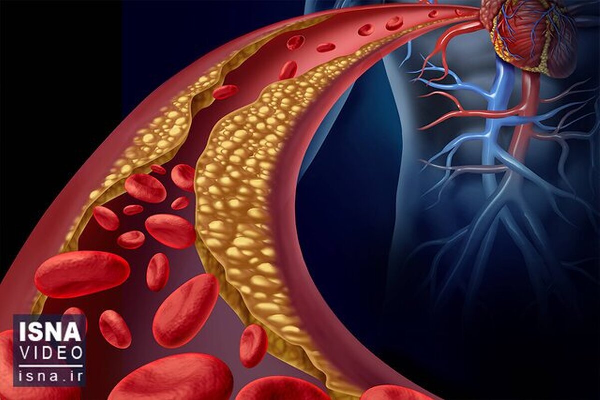 درمان کلسترول خون با یک واکسن جدید