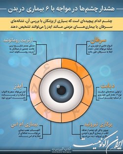 هشدار چشم‌ها در مواجه با ۶ بیماری در بدن