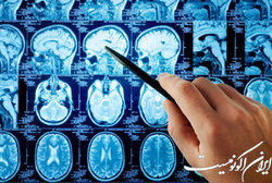 وبینار بررسی «تکنیک FLAIR در Brain MRI» برگزار می‌شود