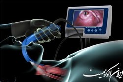 بومی‌سازی دستگاه جراحی حنجره توسط محققان کشور