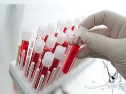 پیگیری ثبت ۲ میلیون داوطلب اهداکننده سلول‌های بنیادی خونساز
