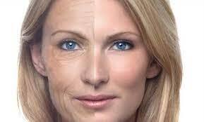 هشدار های جدی که چروک‌های عمیق صورت به شما می‌دهد