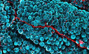 موفقیت در درمان آسیبهای نخاعی با کاشت ایمپلنت موفقیت در درمان آسیبهای نخاعی با کاشت ایمپلنت