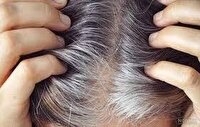 یک پژوهش ژاپنی، سفید شدن موها خبر خوبی برای سلامت