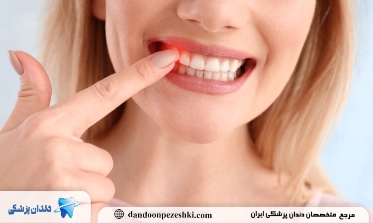 7 نشانه خطرناک بیماری لثه که نباید نادیده بگیرید!