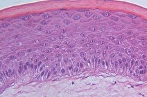 طراحی پوست مصنوعی که رنگ و بافت خود را در مقیاس نانو تغییر می‌دهد