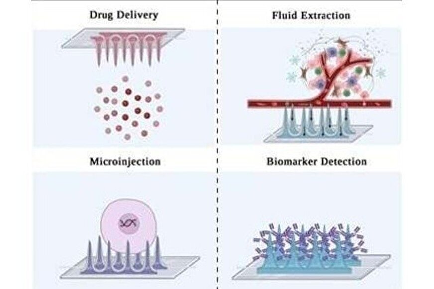 میکرونیدل و نانودارو؛ ترکیبی نوین برای درمان بدون درد