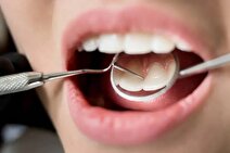 خداحافظ کاشت دندان