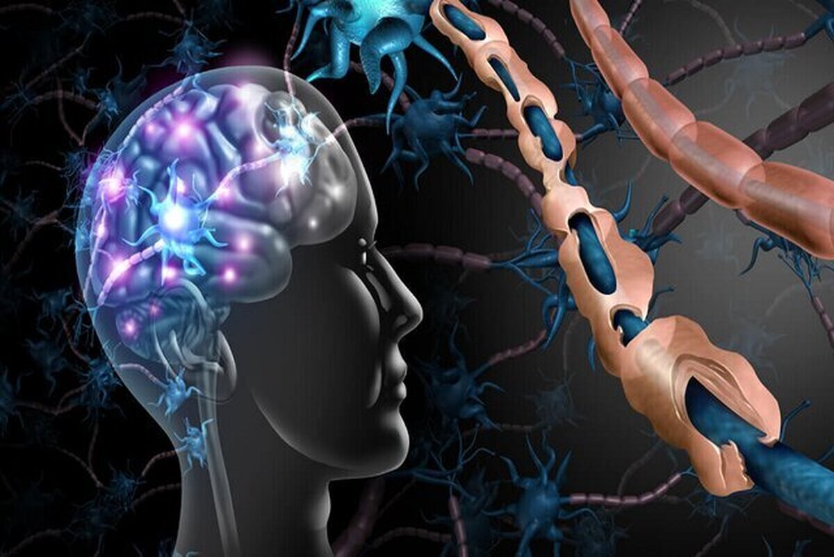 لزوم افزایش آگاهی عمومی نسبت به این بیماری