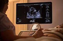 کلید تکامل مغز بزرگ انسان‌ها مرتبط با هورمون جنسی