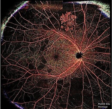 چشم‌ها دریچه‌ای به سلامت قلب هستند