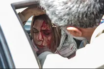 اولین عکس گوهر خیراندیش پس از تصادف