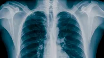 یک سرنخ تازه درباره علت آلزایمر