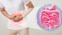 این رژیم غذایی ضد یبوست است