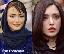 تغییر چهره بهنوش طباطبایی سوژه رسانه های این روزها شد