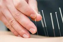 طب‌ سوزنی به کمک درمان کدام بیماری‌ها می‌آید